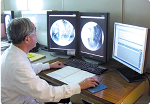 上部消化管X線検査の診断