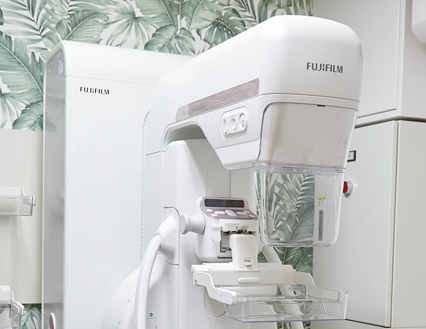 マンモグラフィー